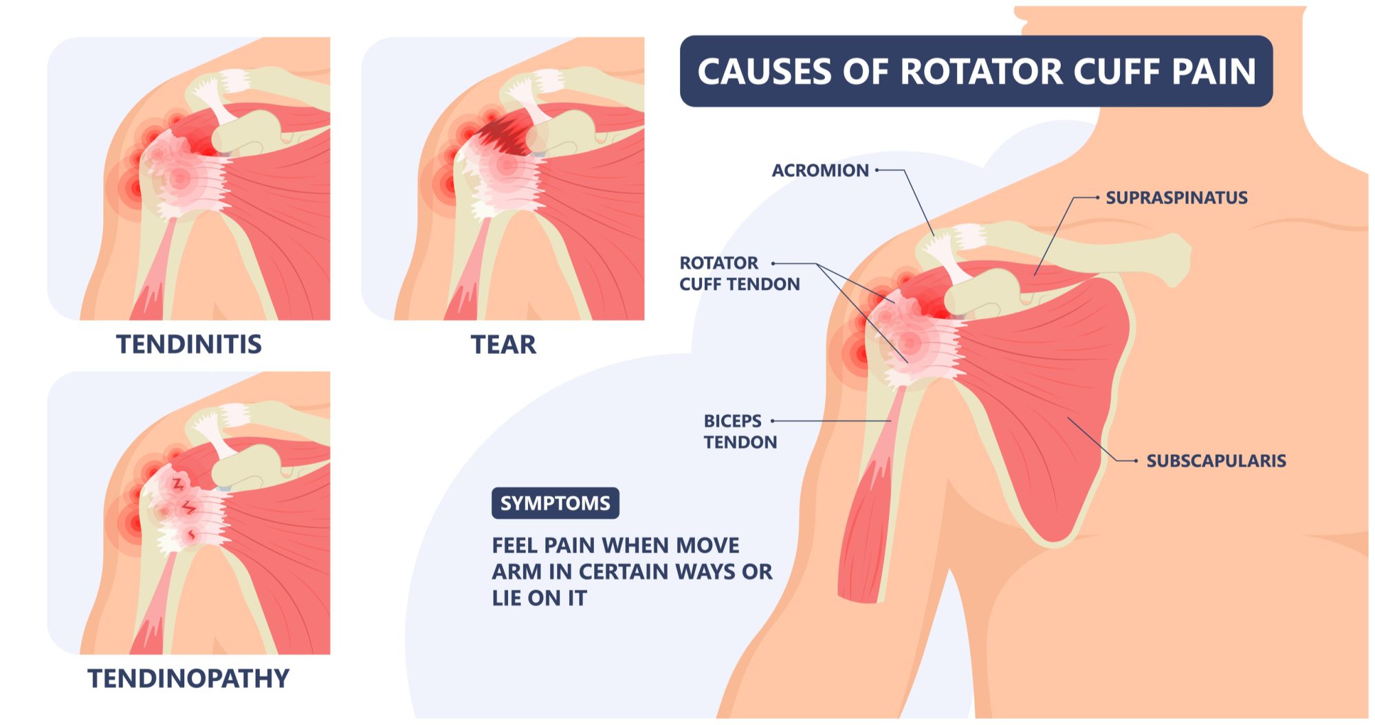 Shoulder on sale injury treatment